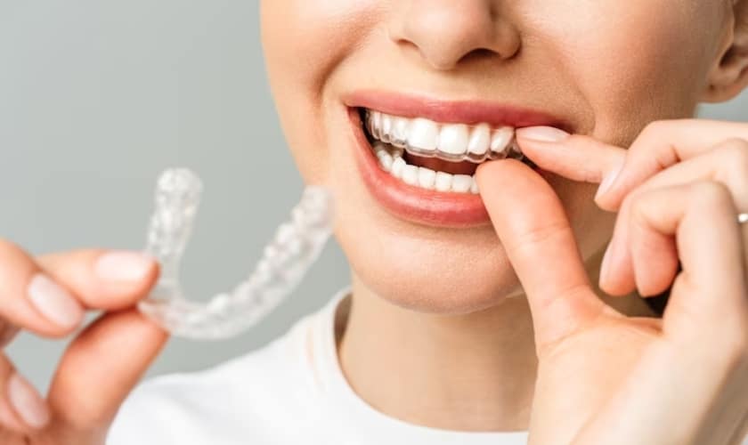 Invisalign Aligner Is Cutting Your Gums