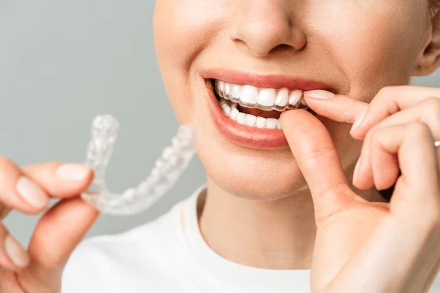 invisalign aligner is cutting your gums